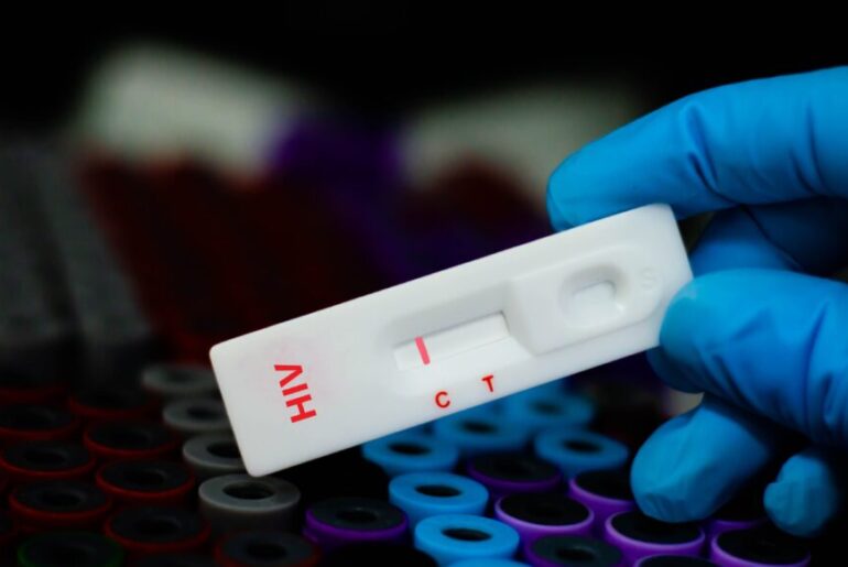 New NK cell immune therapy targets hidden HIV reservoirs