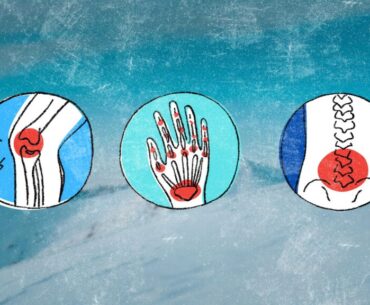 Why Your Muscles and Joints Feel Sore When It's Cold Out