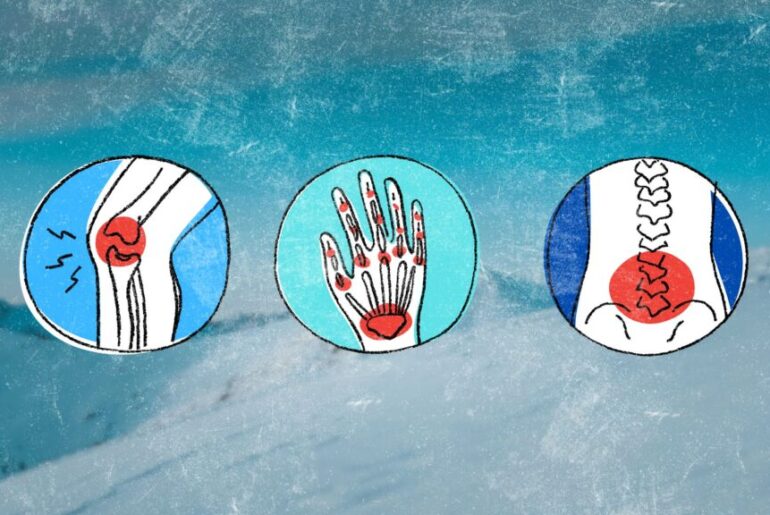 Why Your Muscles and Joints Feel Sore When It's Cold Out