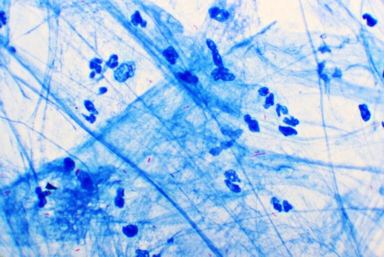 Antibodies Block Bacteria That Cause Tuberculosis