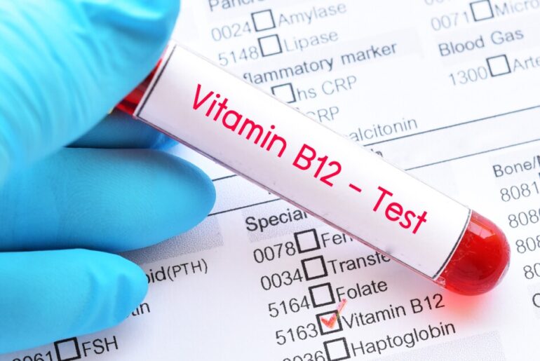 What a registered dietician wants you to know about B12
