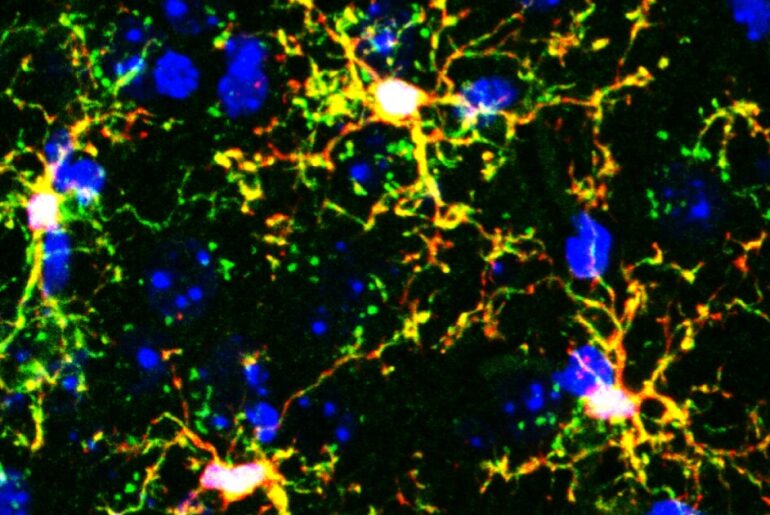 Anxiety is ruled by your immune system, research says