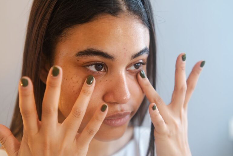 Belif’s Aqua Bomb Eye Cream Depuffs My Under-Eye Bags