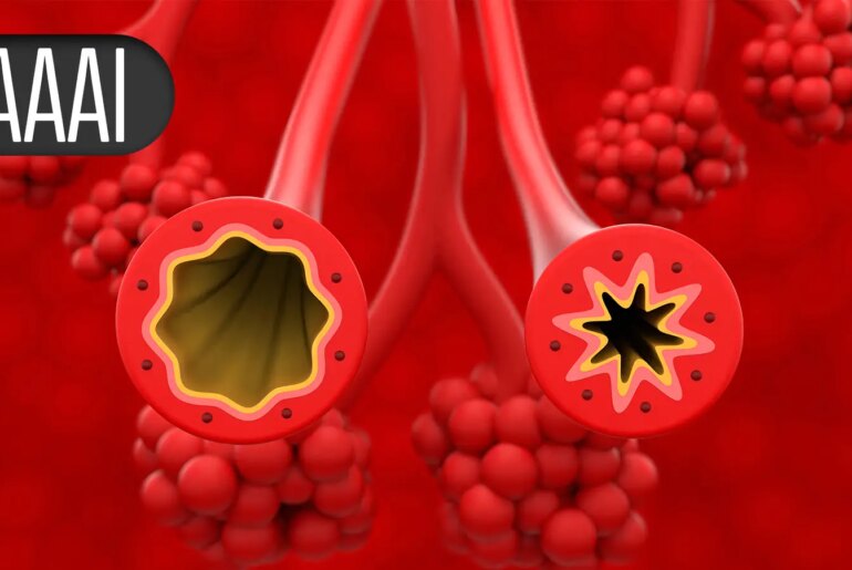 Vitamin D for Babies No Help in Preventing Food Allergy
