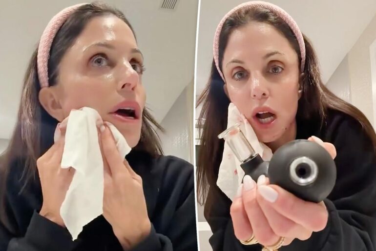 Bethenny Frankel slices her face open with beauty tool in bloody video