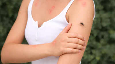 Can immune system of camels give us a new, powerful dengue antidote?