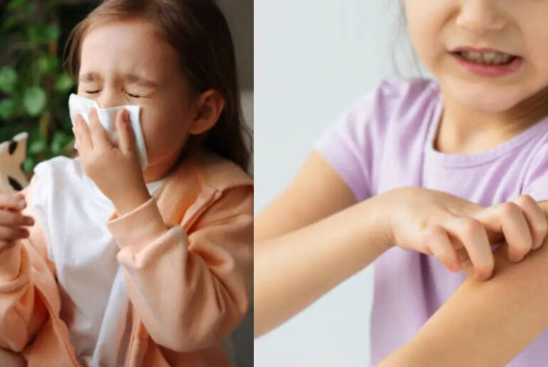 Childhood Allergies on the Rise: Causes, Gut Health and Immunity Explained