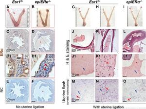 Uterine estrogen receptors help control early pregnancy immune response