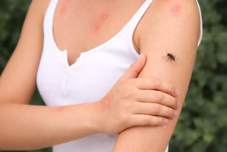 Dengue Antidote: Can immune system of camels give us a new, powerful dengue antidote?