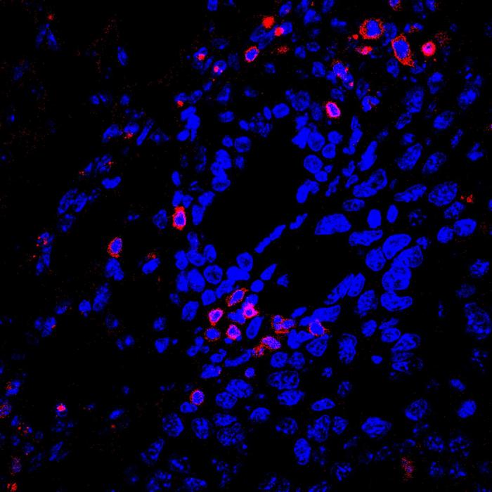 Scanning electron microscopy images of cultured macrophages.