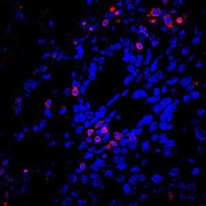 Turning cancer’s protein machinery against itself to boost immunity