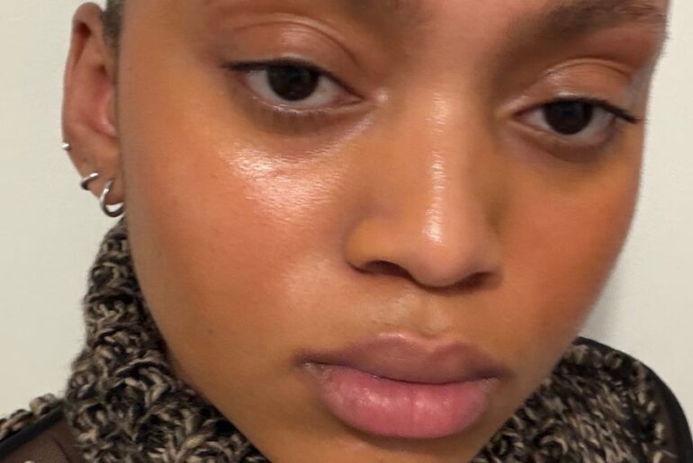 Dear Kalirs Ampoule Mist Review: This K-Beauty Product Saved My Dry Skin