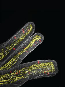 How the immune system triggers a loss of appetite