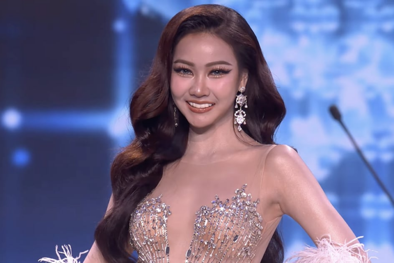 Beauty Queen Loses Her Veneers on Stage Mid-Pageant