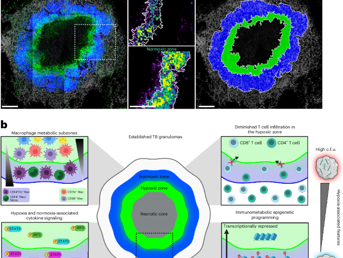 Hypoxia shapes immune cell organization and bacterial control in tuberculosis granulomas