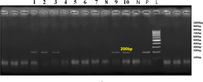 Molecular characterization of bovine viral diarrhea virus and host genetic immune and biochemical responses in diarrheic buffalo calves