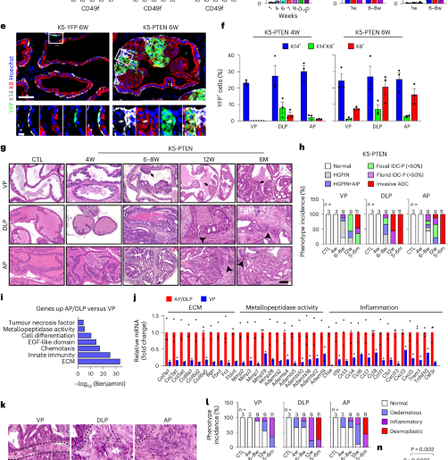 Innate immunity and the NF-κB pathway control prostate stem cell plasticity, reprogramming and tumor initiation