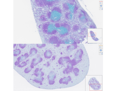 Johns Hopkins Scientists Engineer Nanoparticles Able to Seek and Destroy Diseased Immune Cells