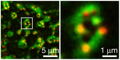 Cell death's 'beautiful' rings: U-M discovery has implications for biological resilience and immunity