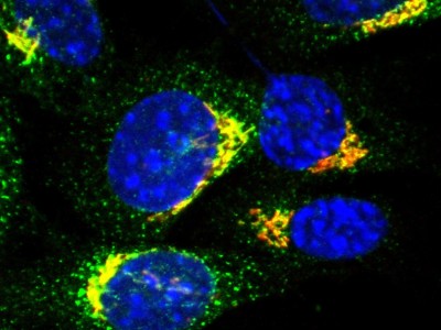 Study identifies transport protein key to immune response