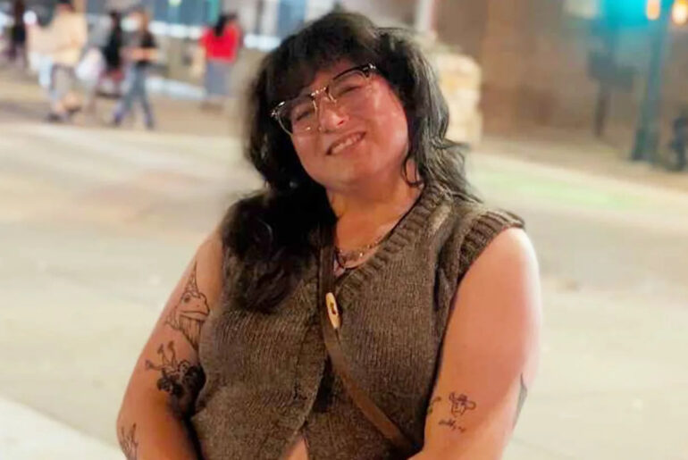 'Super Paranoid' Woman Who Had Scurvy for 'Months' as a Child Reveals Her Weekly Routine to Stay Healthy (Exclusive)