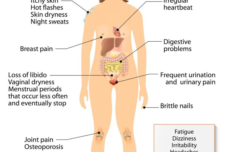 Menopause symptoms range from hot flushes to joint pain to digestive problems. Photo: Shutterstock
