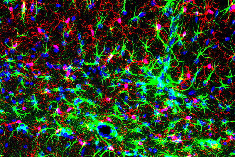 Calcium Signaling Channels Regulate Neuroinflammation and Motivation
