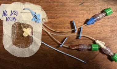 A set of four medical tubes laid out on a desk or table as part of a medical device.