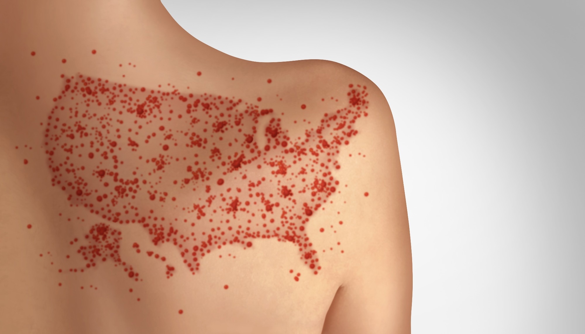 Review: Measles: An Updated Literature Review of the Host Response, Pathogenesis, Complications, Prevention Measures, and Recent Outbreaks. Image Credit: Lightspring / Shutterstock