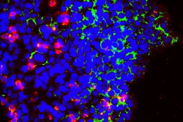 Immune cell ‘bloodhounds’ track cancer cells’ unique metabolic signatures, eliminate tumors in mice