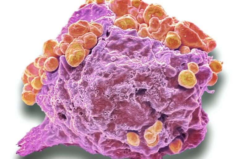 Dual synDNA Vaccine Approach Boosts Immune Response Against T-Cell Lymphoma