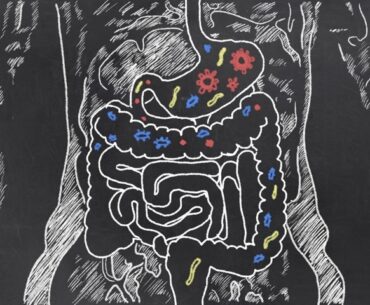 Vitamin D may help shape how the immune system responds to gut bacteria in IBD patients