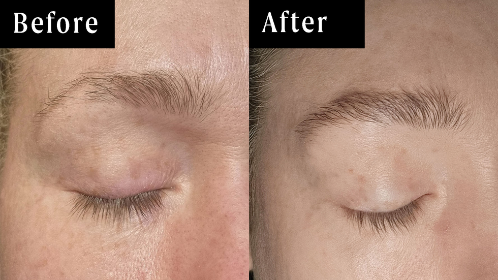 ukbrow before and after