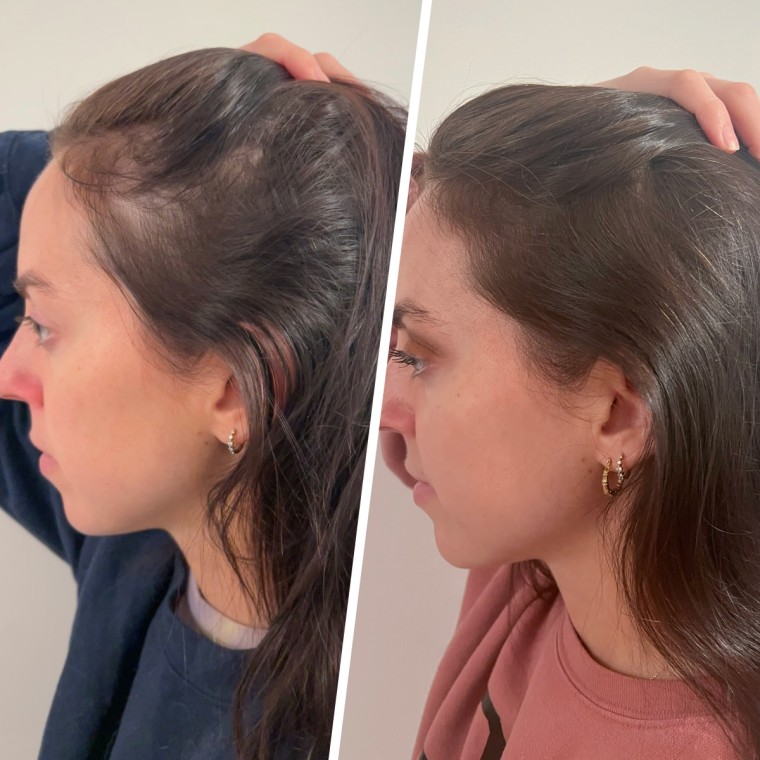 Before and after using the three-step system.