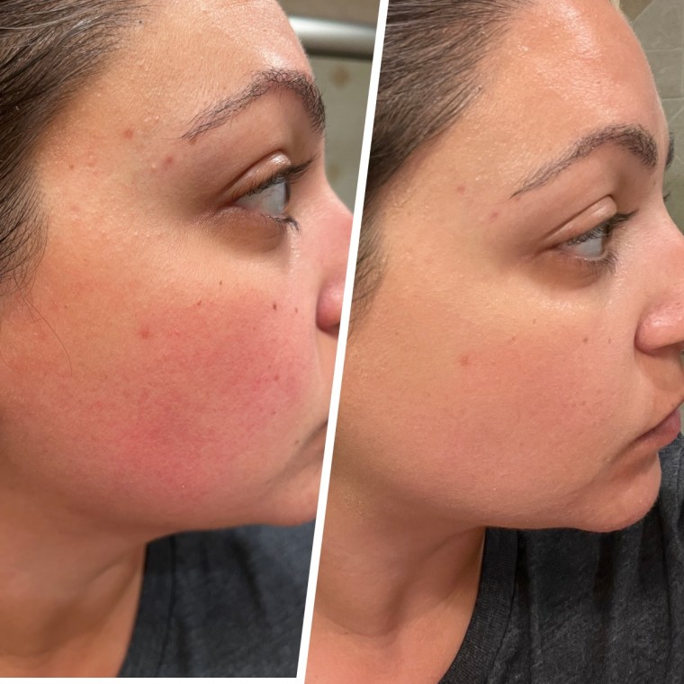 Producer Jillian Gonzalez trying the InnBeauty Project Calm The Red Down Dual-Chamber Serum.