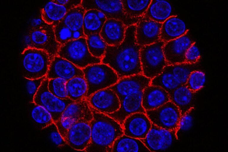 These Supercharged Immune Cells Completely Eliminated Solid Tumors in Mice