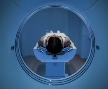 Imaging in Immunotherapy and Autoimmunity