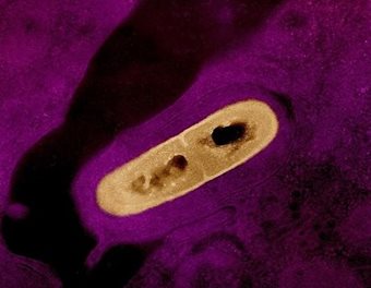 A listeria cell