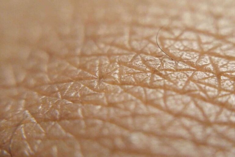 Skin holds an unexpected trick to bolster the body’s defenses