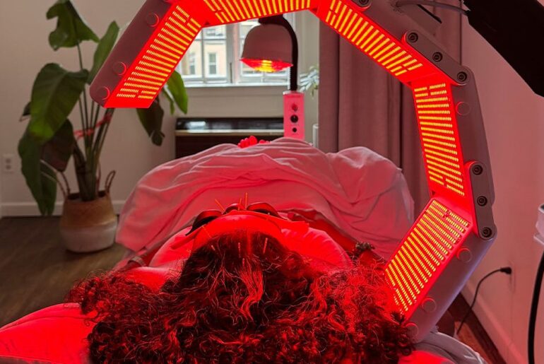 I Had 20+ Needles In My Face and I’ve Never Looked Better