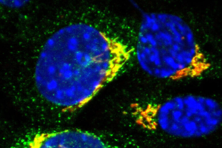 Study identifies transport protein key to immune response: Newsroom