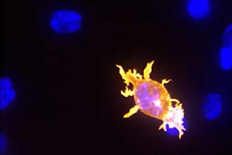 Scientists create cancer-fighting immune cells right in the body