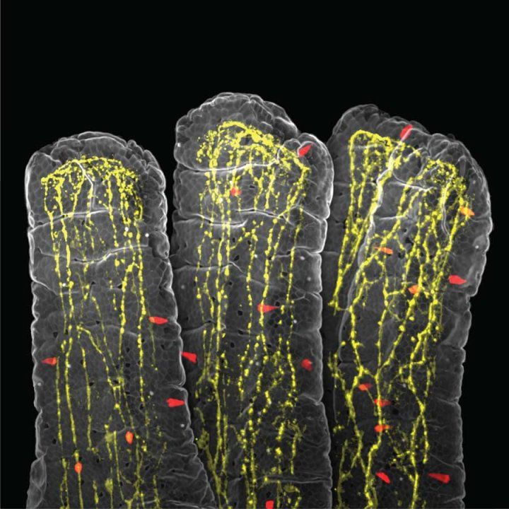 A microscopic image shows several finger-like structures called villi against a black background. The villi are filled with a glowing yellow network, and small, red almond-shaped cells-known as tuft cells-are scattered throughout the network.