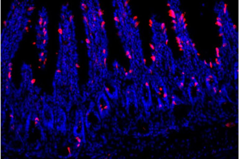 A microscopic image shows several blue, finger-like structures called villi against a black background, which are densely covered with numerous bright pinkish-red spots, which are specialized cells known as tuft cells.