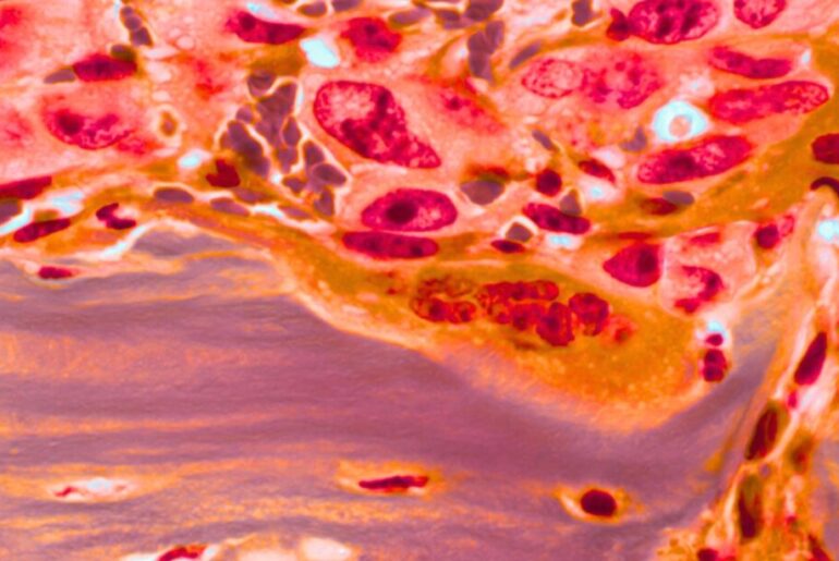 Blocking biotin could expose a weakness in cancer cells