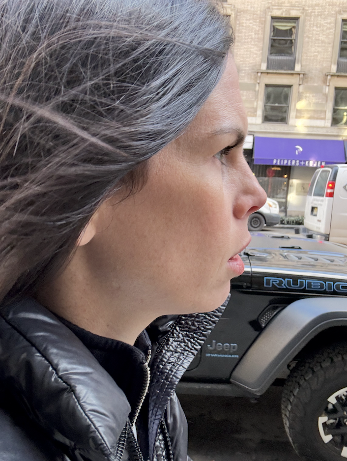 Diana's profile before FaceTite. 