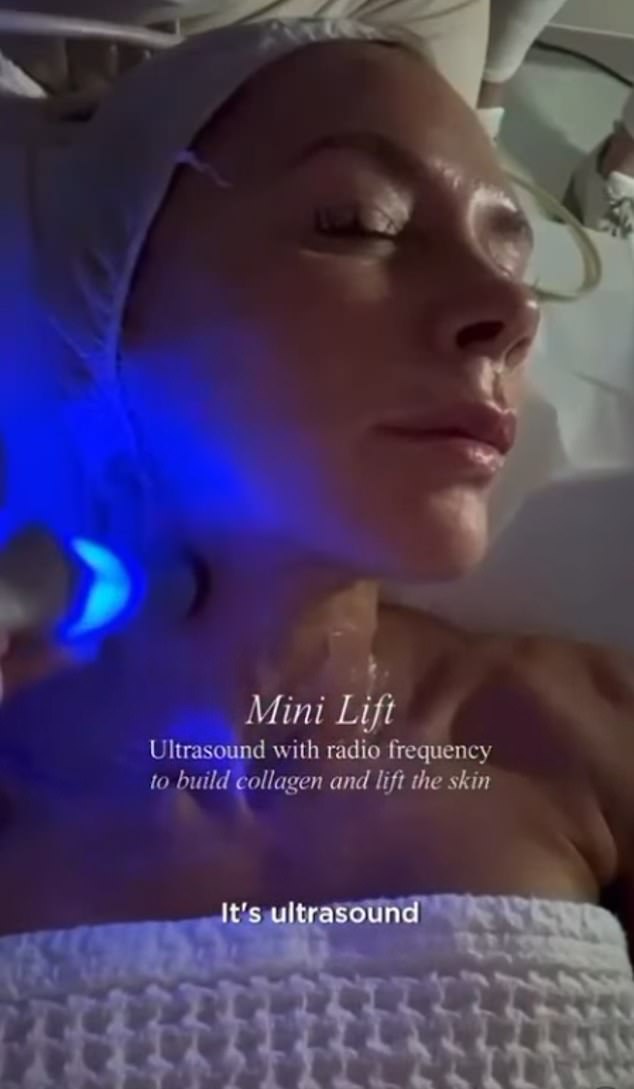 Last year, A-list facialist Keren Bartov shared an Instagram post of her performing a 'mini lift' on Victoria
