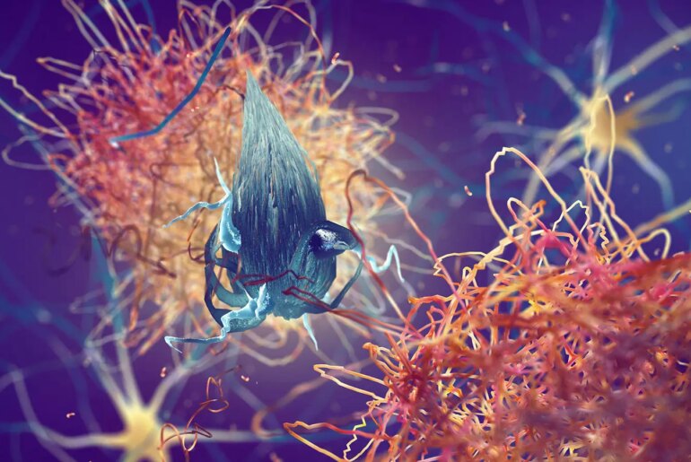 A computer rendering of amyloid plaques forming between neurons.