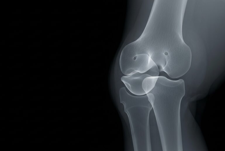 A ghostly, translucent X-ray image revealing the internal structure of a human knee joint, conceptually representing the guide