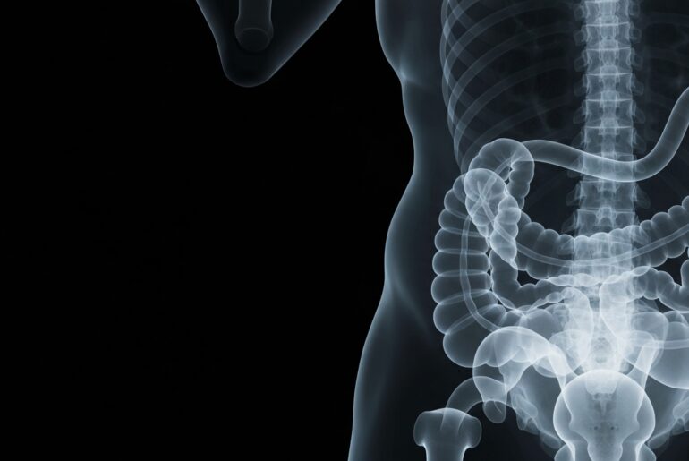 A ghostly, translucent X-ray image revealing the internal structure of the human digestive system, conceptually representing the limitations of AI-powered nutrition guidance.